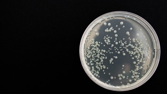 Office bacteria in a dish